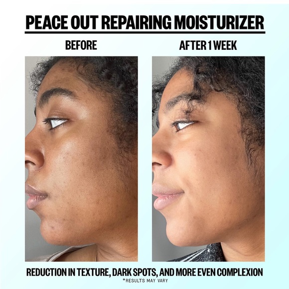 Bundle Only💫 Peace Out Skin Blemish Repairing Moisturizer Cream Mini Size NEW - Picture 3 of 4